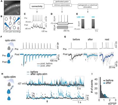 Neural ensembles: role of intrinsic excitability and its plasticity